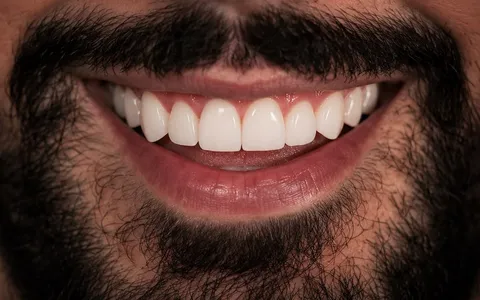 Close de sorriso com dentes alinhados, resultado de tratamento ortodôntico