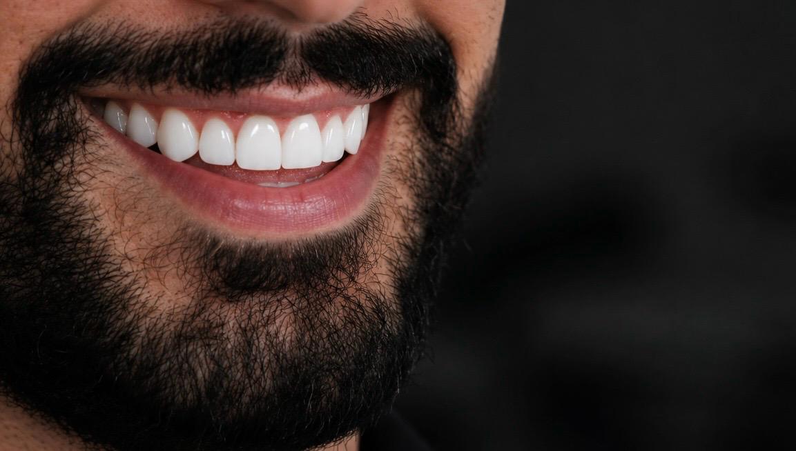 Close cinematográfico de um sorriso masculino natural com dentes alinhados e brancos